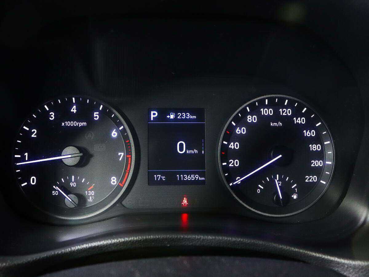 Hyundai Solaris с пробегом — 2017 год. Фото: #10